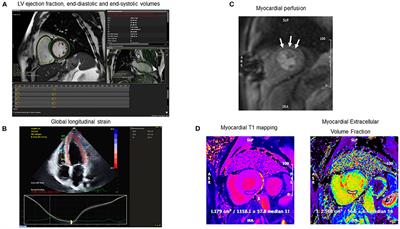 A Contemporary Review of the Effects of Exercise Training on Cardiac Structure and Function and Cardiovascular Risk Profile: Insights From Imaging